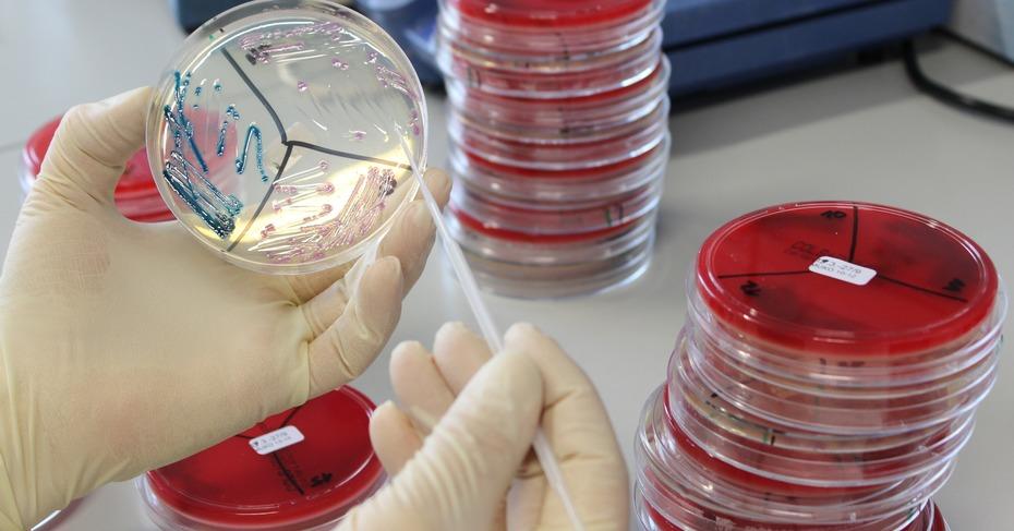 Top 10 Infectious Disease Diagnostics Companies