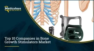 BONE GROWTH STIMULATORS MARKET