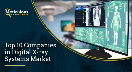 Digital X-ray Systems Market